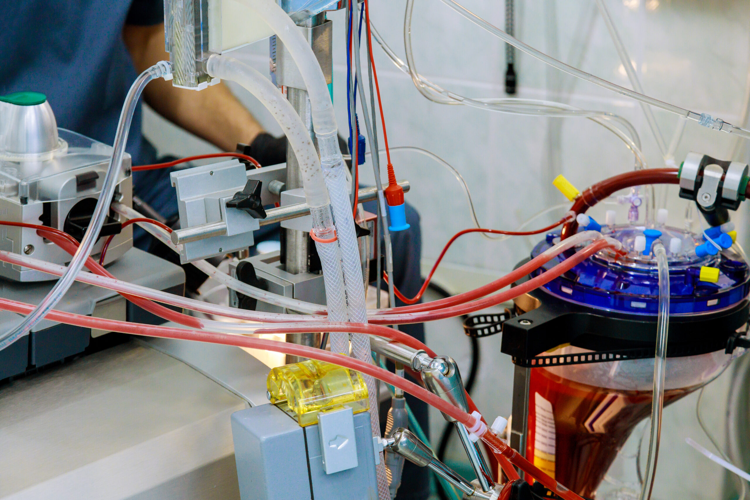 Operating room for during heart surgery lung machine in apparatus circulation blood heart